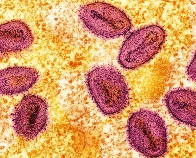 Mpox virus